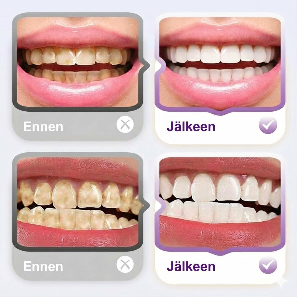 Lysotsyymi kirkastava tahranpoistohammastahna