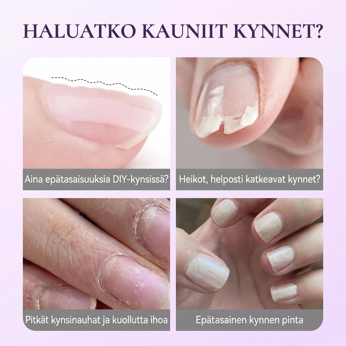 3-in-1 kynsinauhojen hoitokynä
