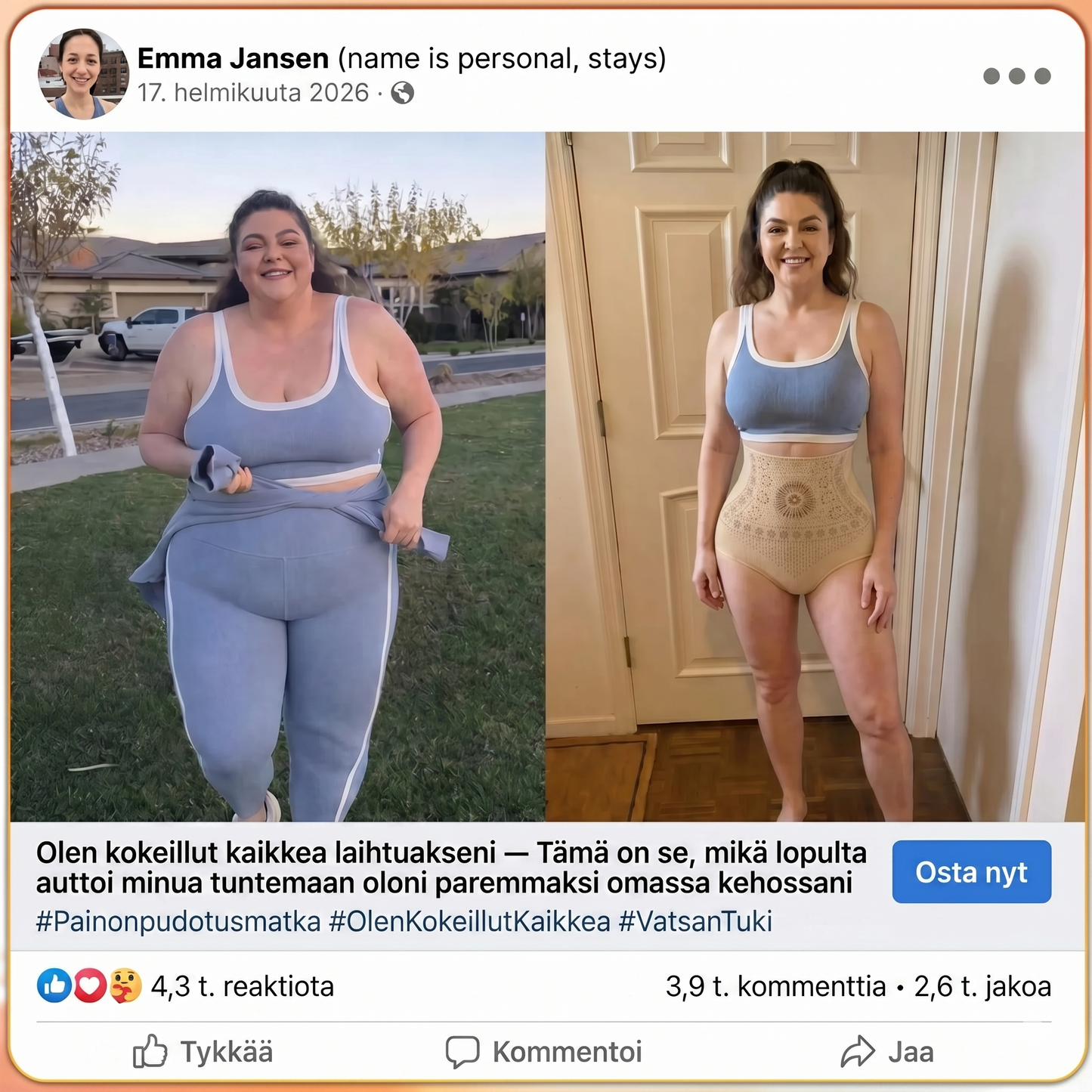 Muotoilevat korkeavyötäröiset shortsit