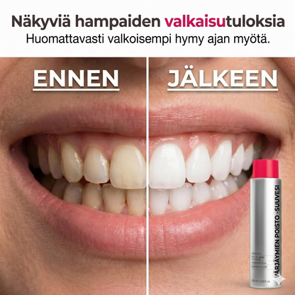 Tahroja poistava valkaiseva suuvesi