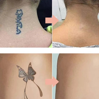 Tehokas tatuoinnin häivytysvoide miedolla ja turvallisella koostumuksella